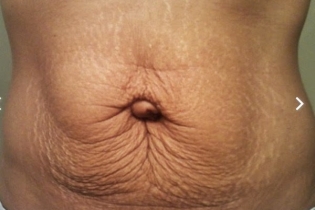 Những vấn đề chị em sau sinh thường gặp